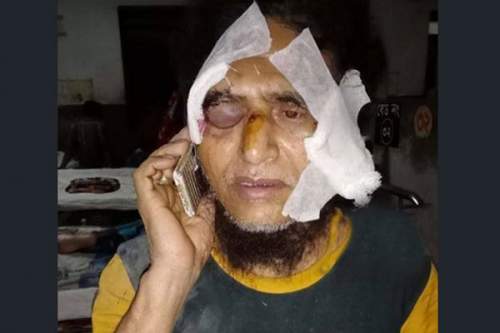 অতিরিক্ত ভাড়ার প্রতিবাদ, মারধর করে যাত্রীর মুখমণ্ডল ফাটালেন চালক