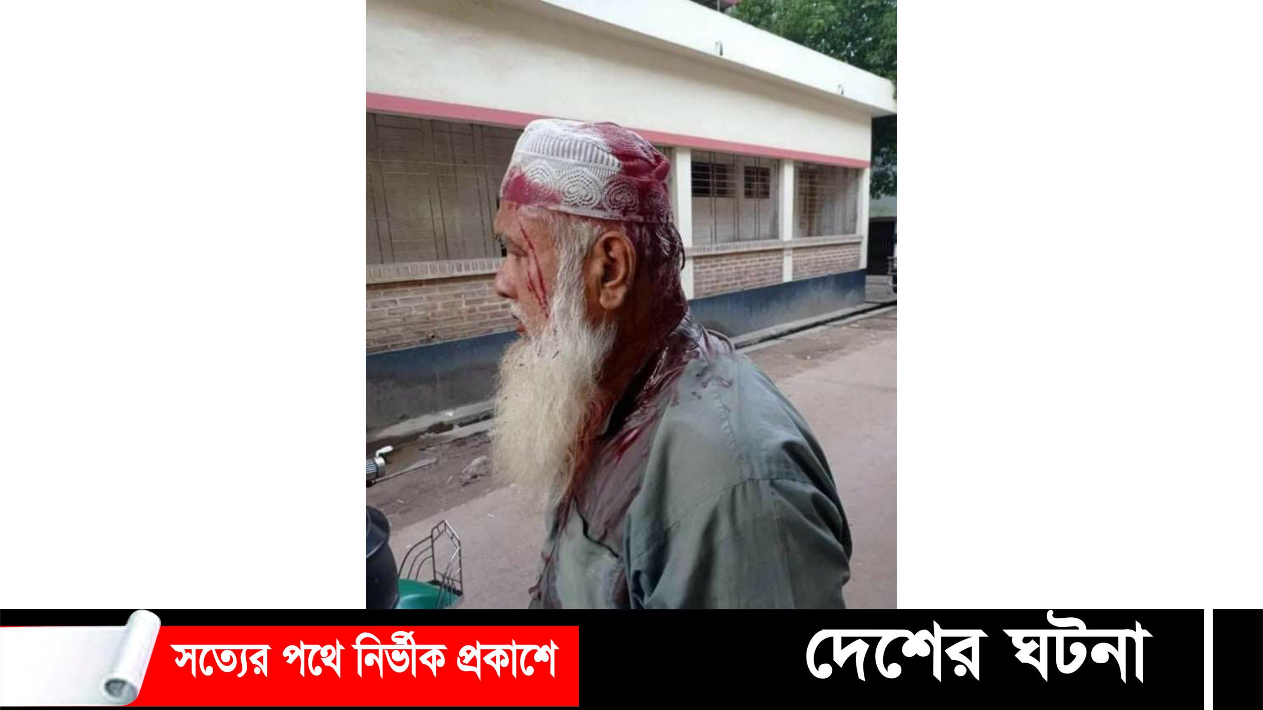 দেবীদ্বারে এক শতাংশ জমির মালিকানা নিয়ে সংঘর্ষে আহত ১০: আটক -২