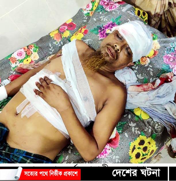 মুরাদনগরে ব্যবসায়ীকে ছুরিকাঘাতে হত্যার চেষ্টা: আটক ১