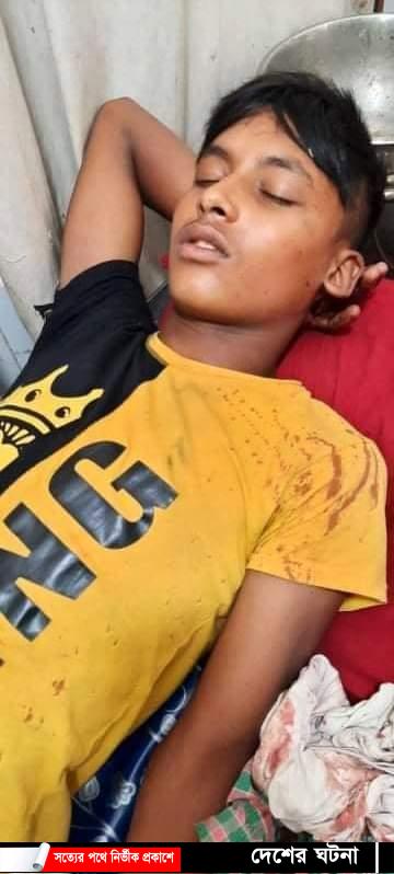 পটকা বানানোর সময় বিস্ফোরণে শিক্ষার্থী আহত