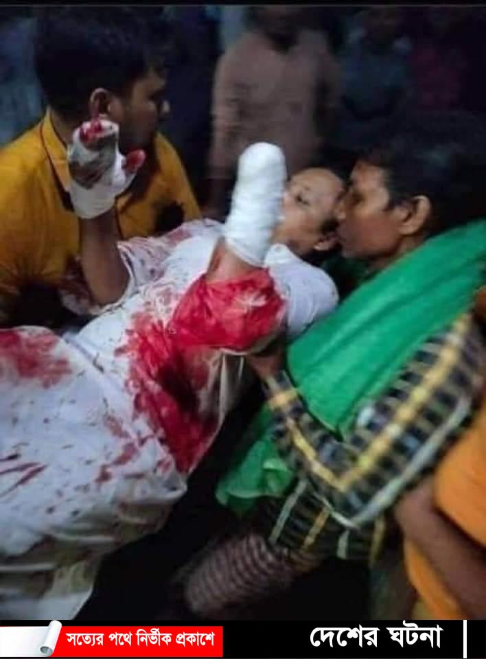 বরিশাল বাবুগঞ্জে ইমামের হাত কেটে নিলো সন্ত্রাসীরা