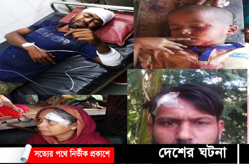 বরুড়ার খোশবাসে স্বতন্ত্র প্রার্থী সমর্থদের হামলায় আহত-৫