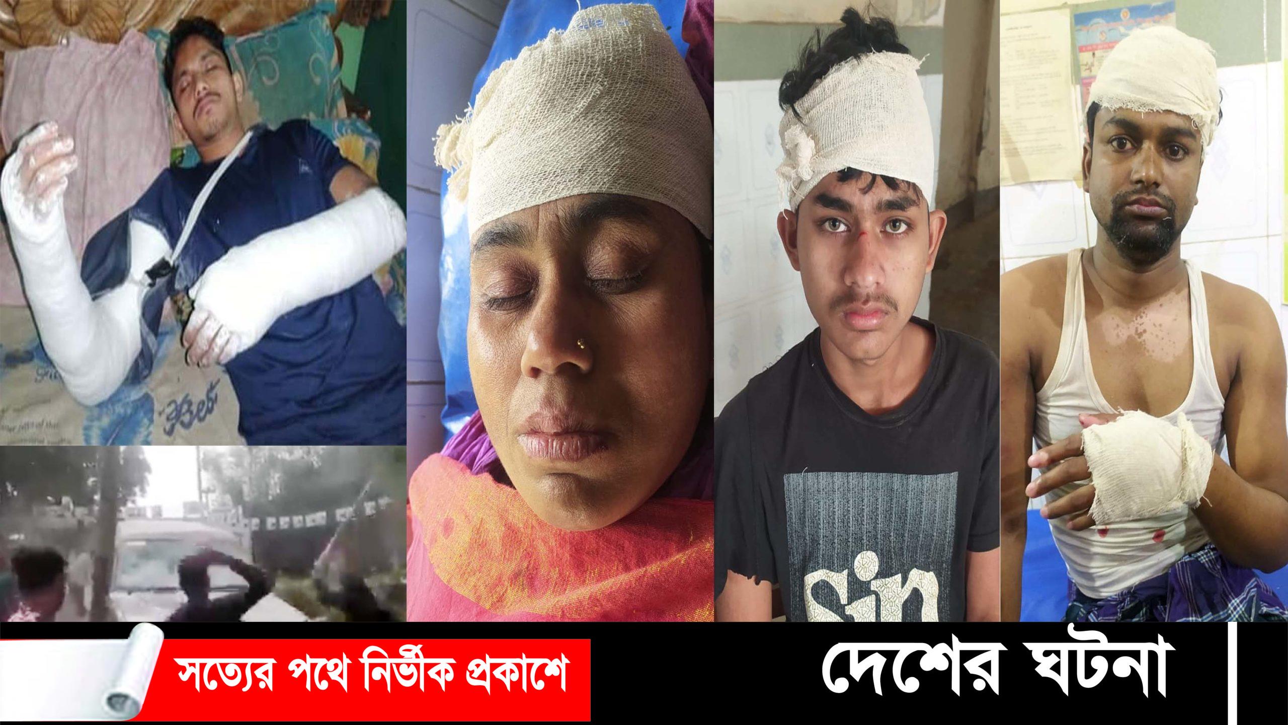 মুরাদনগরে নির্বাচনী সহিংসতায় ২৫ স্থানে ৫ পুলিশ সদস্যসহ আহত ১০১