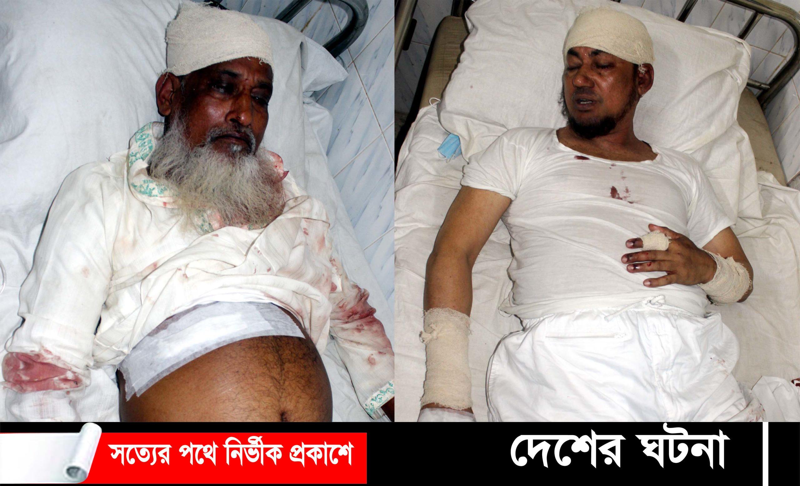 মুরাদনগরে মাদরাসা পরিচালকসহ দু’জনকে কুপিয়ে জখম