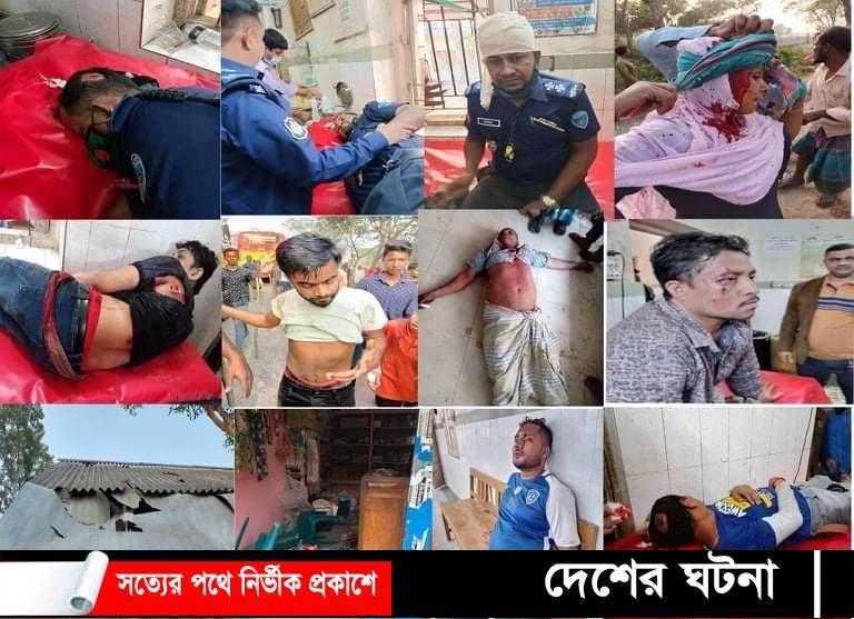দেবীদ্বারে নির্বাচন সহিংসতায় ৪পুলিশসহ আহত ৩০,নারীসহ গেফতার-১২