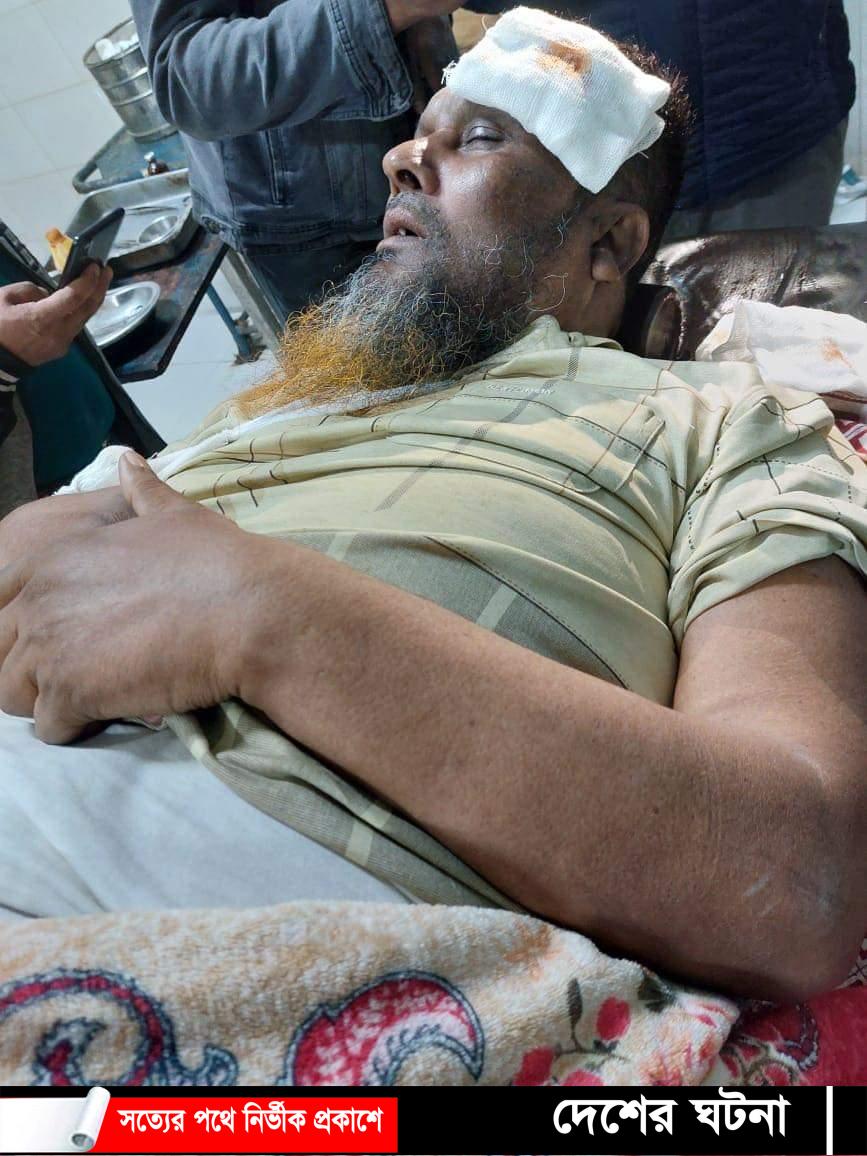 দেবীদ্বারে আ’লীগ নেতা ইউপি মেম্বারকে কুপিয়ে জখম