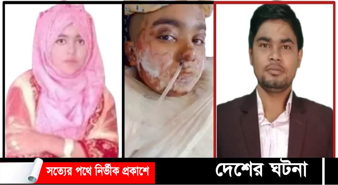 দেবীদ্বারে স্ত্রী’র গায়ে আগুন,আইসিইউতে ৮ দিন থাকার পর মৃত্যু