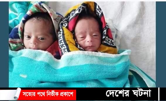 কুমিল্লায় জমজ শিশুর জন্ম,নাম পদ্মা-সেতু