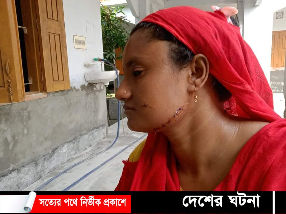 নড়াইলের টেইলার্স কর্মীকে কুপিয়ে গুরুতর আহত করেছে তালাকপ্রাপ্ত স্বামী