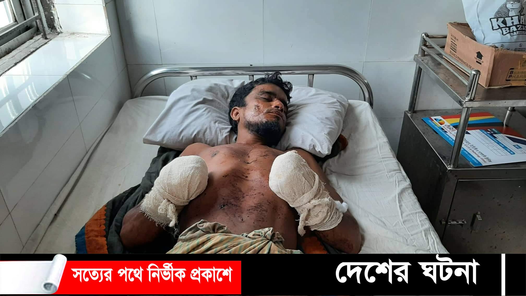 পিরোজপুরে পারিবারিক কলহ: স্বামীর দুই হাতের কবজি বিচ্ছিন্ন