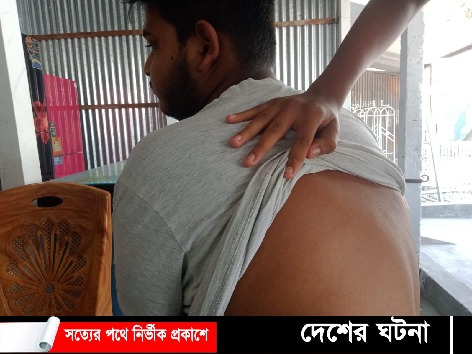 চরভদ্রাসনে শিক্ষকের বেত্রাঘাতে শিক্ষার্থী আহত