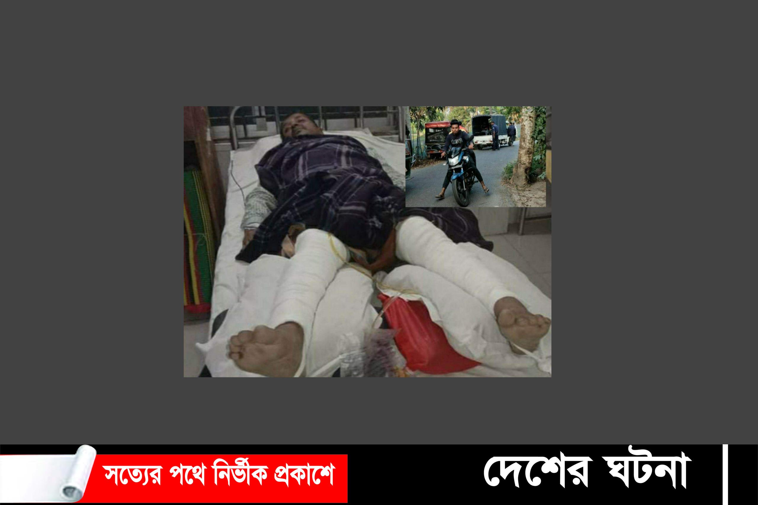 বটিয়াঘাটায় সড়ক দূর্ঘটনায় আহত এক শিক্ষক