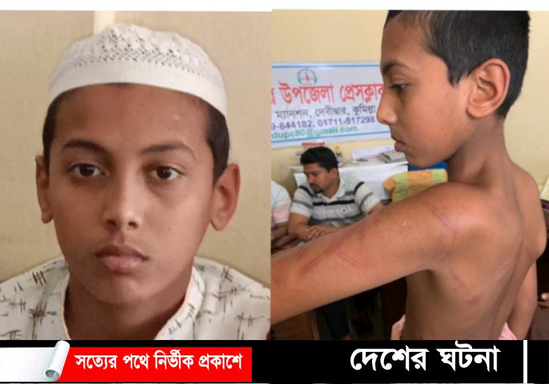 বড় হুজুর আমার বুকে পাড়া দিয়া ধইরা ২ বেত দিয়া পিটাইছে