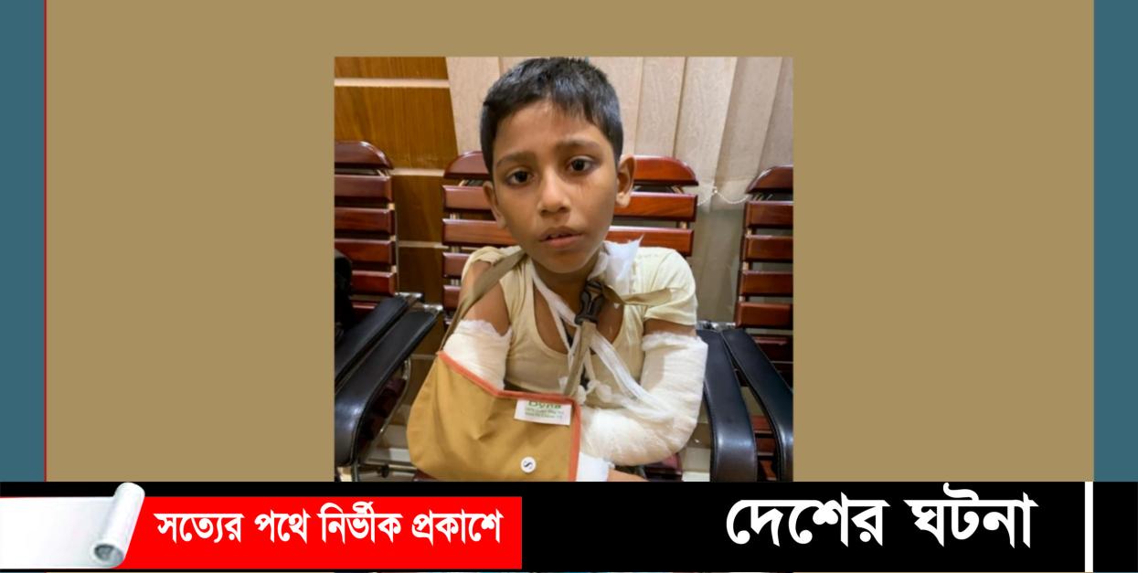 মাদ্রাসা ছাত্রের কান্ড! ৬ তলা থেকে রসি বেয়ে নামতে ভেঙ্গে যায় দুই হাত