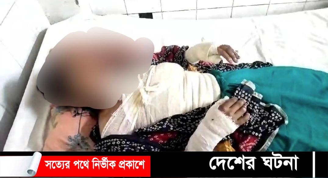 গৃহবধূর শরীরে কেরোসিন ঢেলে পুড়িয়ে হত্যার চেষ্টা: গ্রেপ্তার ৪