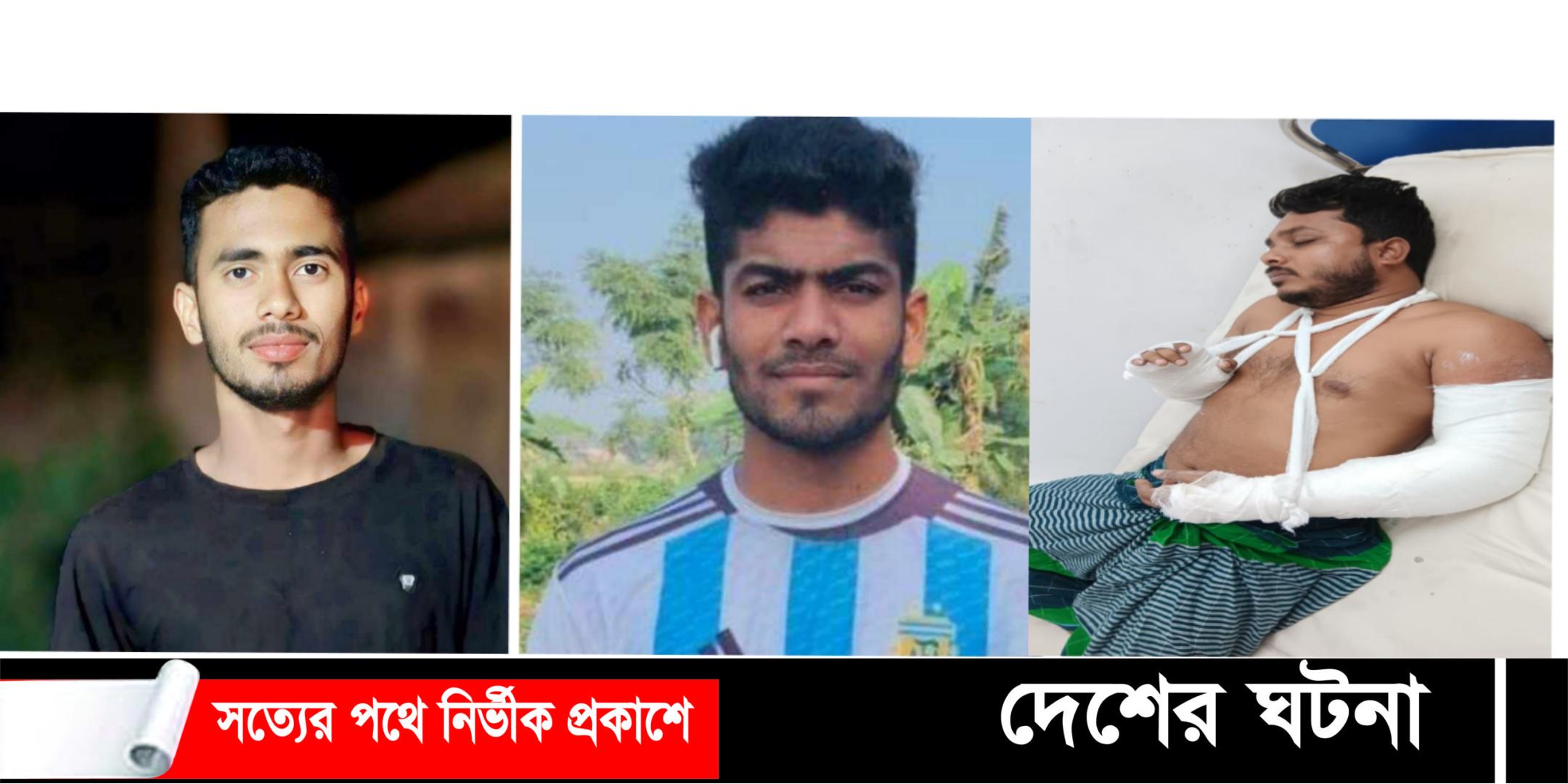 ইভটিজিংয়ের প্রতিবাদ করায় শিক্ষকের দুই হাত ভেঙ্গে দিল কিশোর গ্যাং