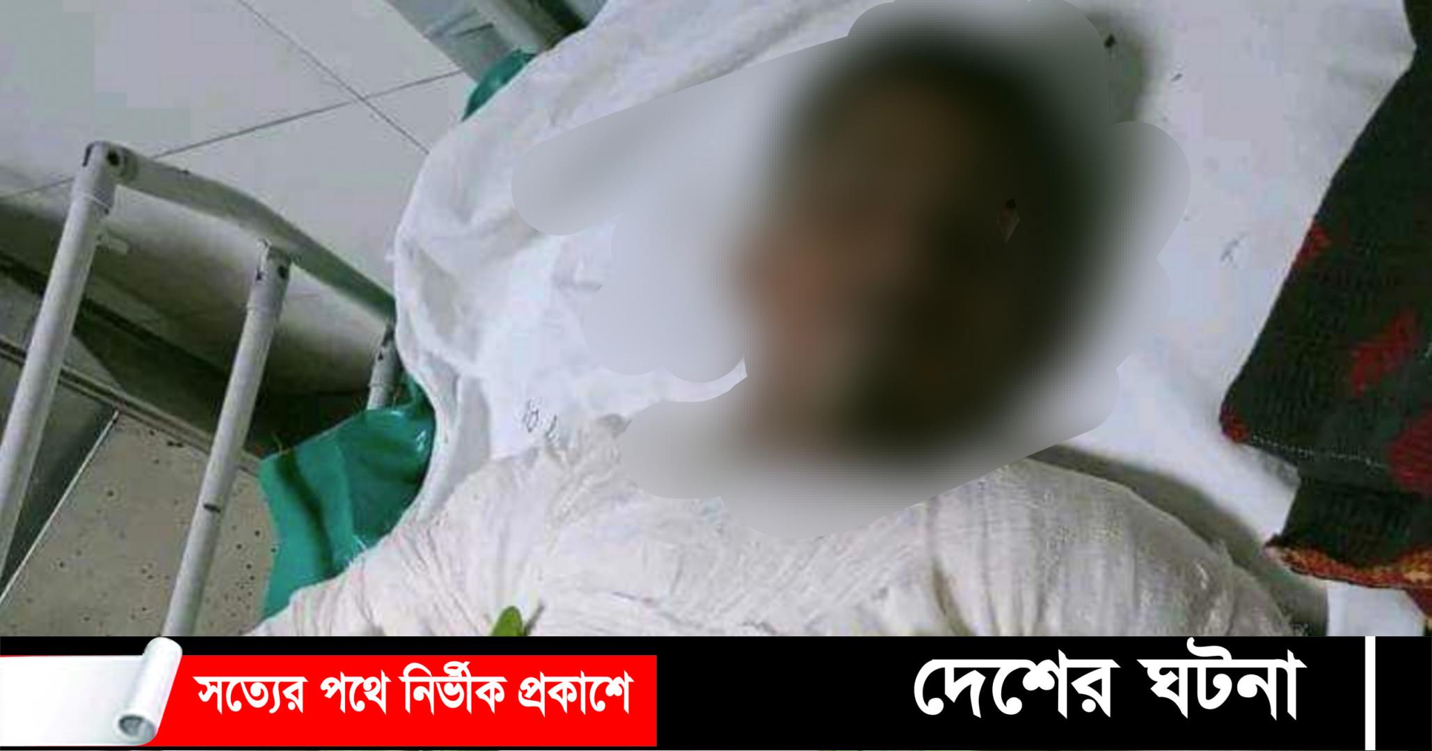 কুষ্টিয়ায় গ্যাস লাইট বিস্ফোরণে ঝলসে যাওয়া কিশোরের মৃত্যু