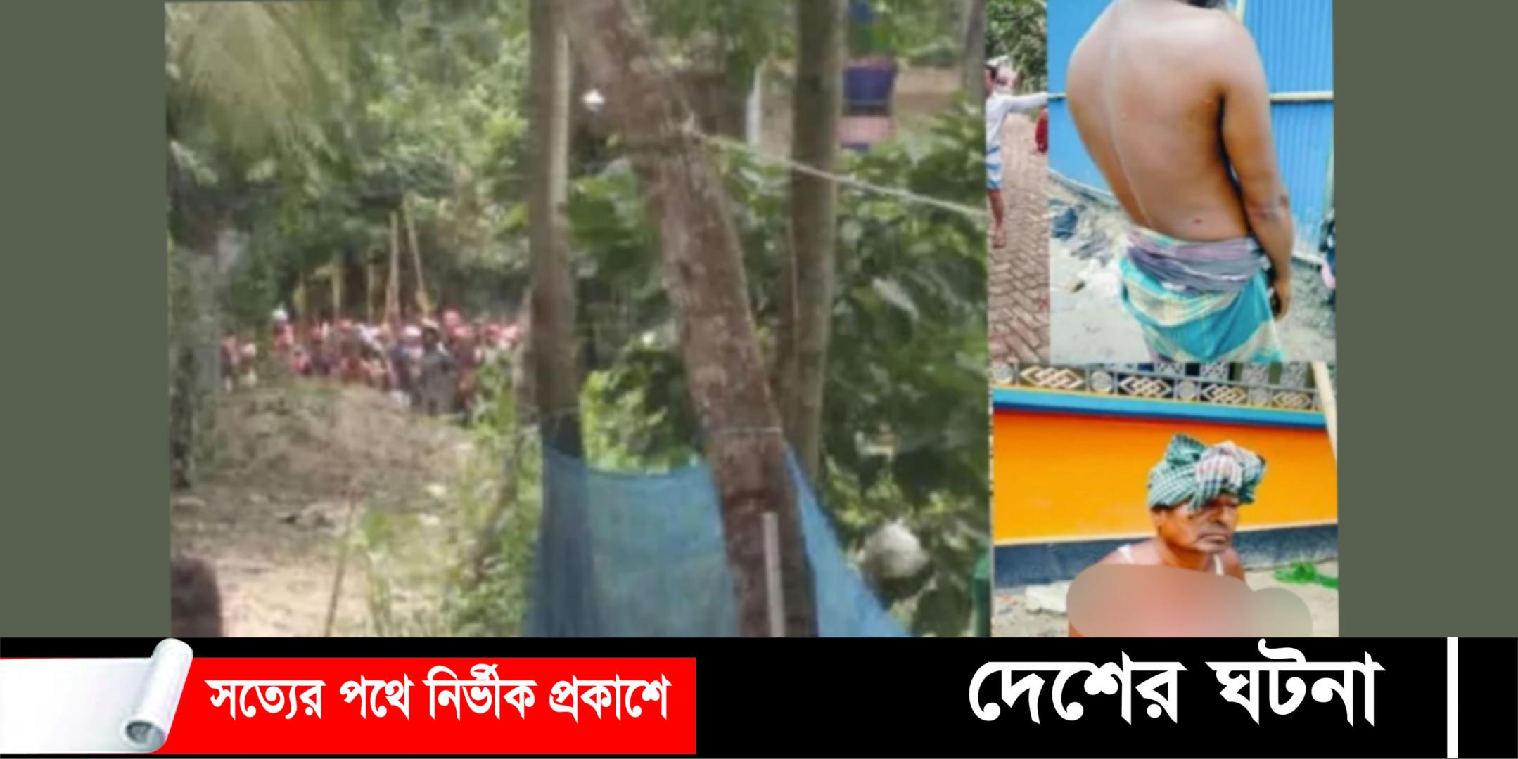 নাঙ্গলকোটে গরুর ঘাস খাওয়া নিয়ে সংঘর্ষ, গুলিবিদ্ধ- ৬